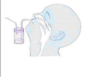 Lavado nasal y recolección de hisopos