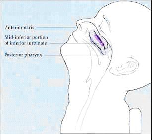 PROF-Nasal-Wash-no-suction-1.JPG