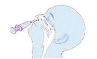 PROF-Nasal-Wash-no-suction-2.JPG